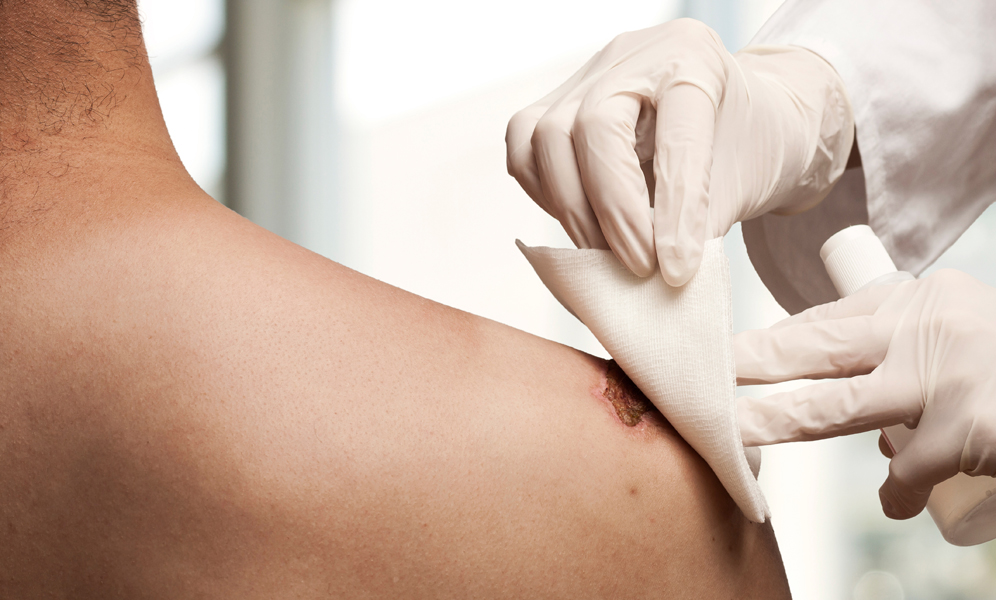 Healthcare, Innovative Wound Care | smart nonwoven solutions by TWE