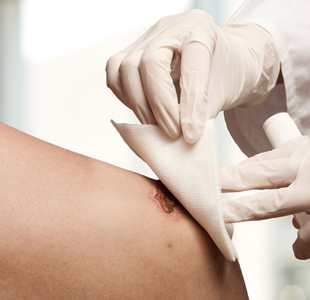 Healthcare | Vliesstoffe von TWE